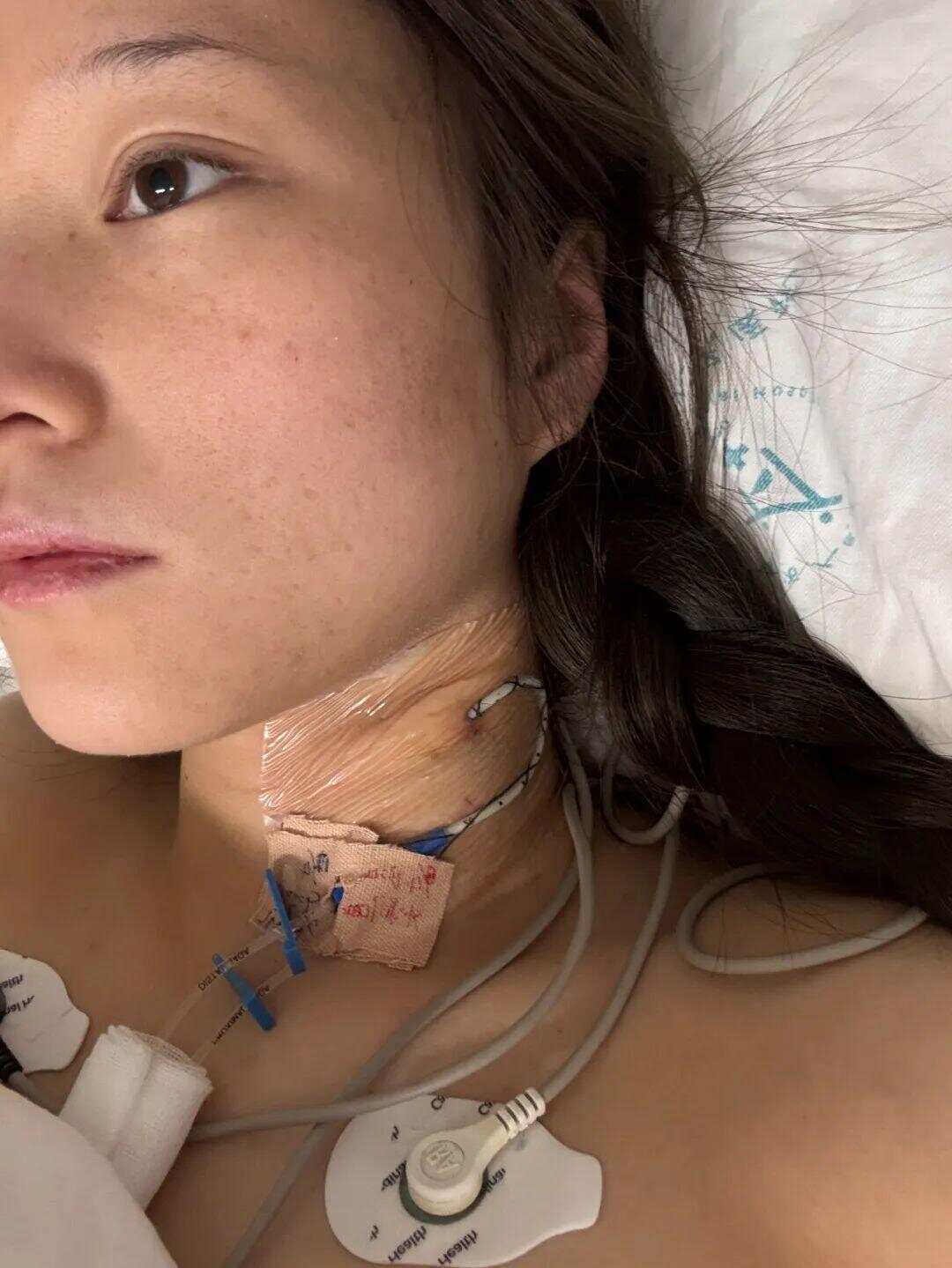 男子驾车出车祸致女友截瘫！ 女方称男友全家失联